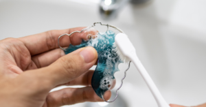 Tips for Cleaning a Retainer